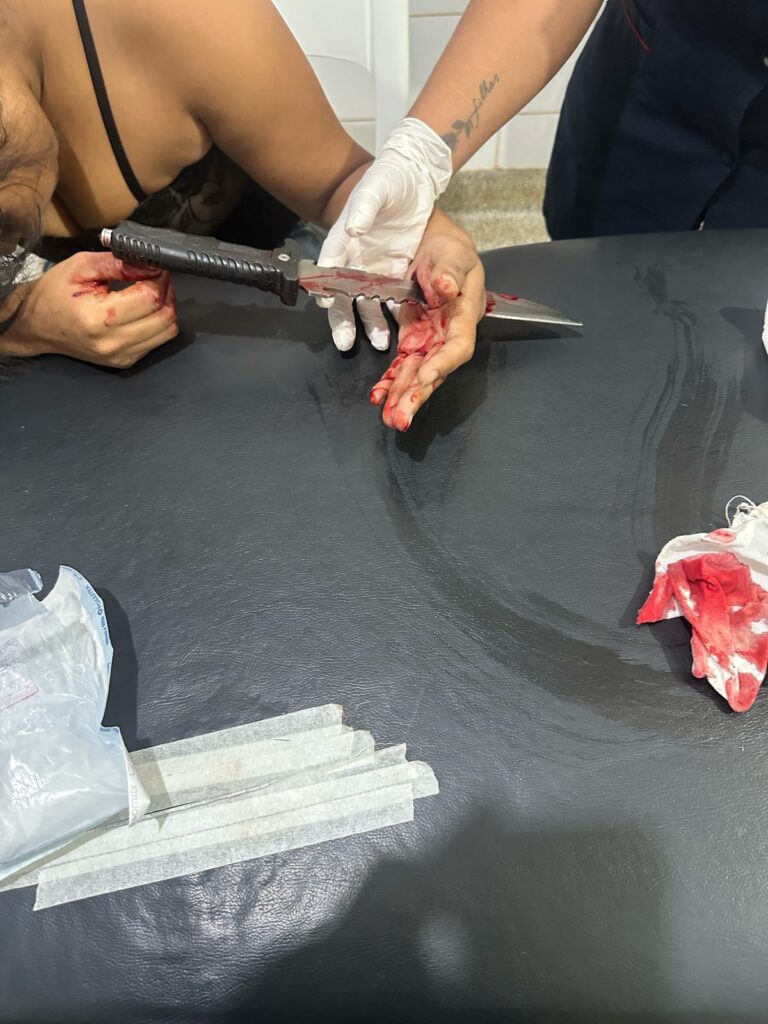 Dourados: mulher que teve faca cravada na mão pelo ex é liberada do HV Dourados: mulher que teve faca cravada na mão pelo ex é liberada do HV