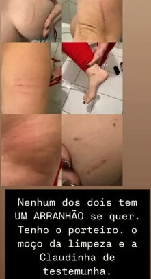 Influenciadora é agredida por ex-marido e ex-sogra em saguão do próprio apartamento Influenciadora é agredida por ex-marido e ex-sogra em saguão do próprio apartamento