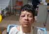Esposa denuncia abandono após acidente com quebra-mola não sinalizado em Dourados