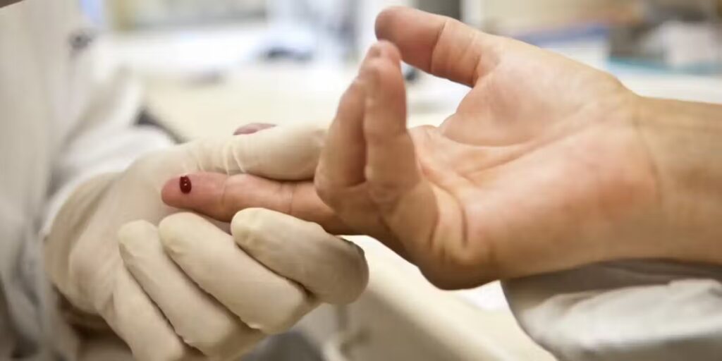 HIV: Cientistas conseguem entrar nas células infectadas e avançam na cura da doença HIV: Cientistas conseguem entrar nas células infectadas e avançam na cura da doença