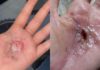(Vídeo) Mulheres denunciam tortura e ameaças durante ritual espiritual em terreiro de MS