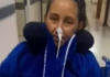 Mulher é internada para laqueadura, sai sem uma perna e com coração novo