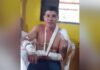 'Ela pulou no meu peito': homem relata ataque de onça em estrada de MS; assista