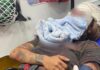 Mulher que levou 61 socos do namorado e ficou com rosto deformado foi operada