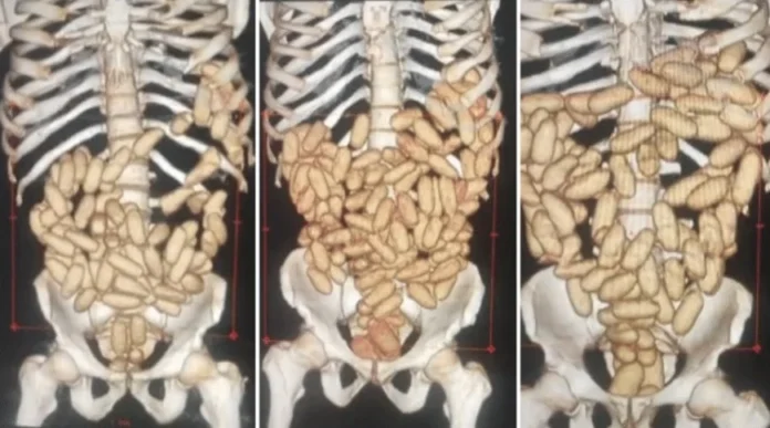 image_870x_68cba43cc2d7a