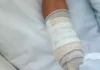 Menino de 8 anos tem mão amputada ao confundir explosivo com pedal