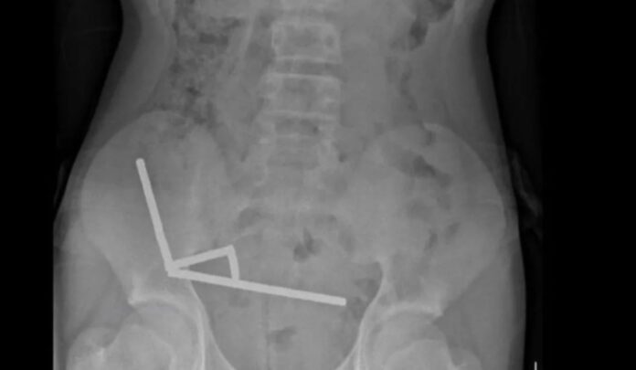 engolir-mais-de-80-imas