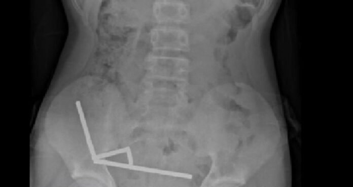 image_870x_68fff46694411