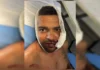 'Achei que ia morrer', diz jovem que teve rosto rasgado por advogado