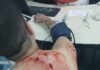 Homem chama motorista por aplicativo e tenta roubar moto com golpes de faca 