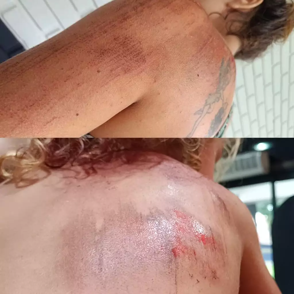 Motorista que arrastou babá e criança é posto em liberdade provisória em Dourados