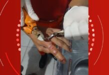 Bombeiros cortam anel que fica preso em dedo de homem 
