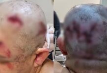 Acusado de tentar matar ex-namorada a marretadas vai a julgamento