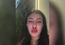 'Nada justifica': jovem diz que levou soco de ficante e apagou em bar