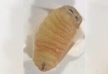 Miíase nasal: o que é a condição que fez mulher espirrar vermes após ataque de moscas