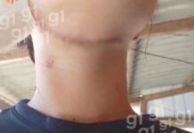 Jovem pediu para reatar namoro antes de tentar degolar adolescente: 'Deu um mata-leão'