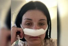 Mulher descobre tumor cerebral após sintomas tratados como estresse