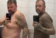Homem perde vesícula e tem complicações após comprar GLP-1 online