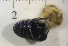 Com infecção rara, mulher espirra larvas e pupa de mosca