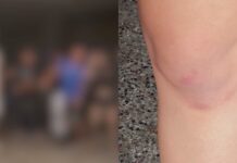 ‘Acordei sem roupa’: adolescente denuncia estupro coletivo em reunião de amigos