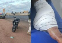 MS: diarista tem parte da perna amputada após ser atingida por carro que fugiu