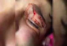 'Achou que ia morrer', diz mãe de adolescente espancado por PM