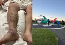 Homem leva duas picadas de cascavel e esgota o soro de hospital