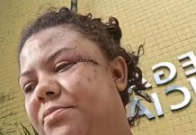 Mulher esfaqueada 19 vezes pelo ex-companheiro vive escondida e faz apelo