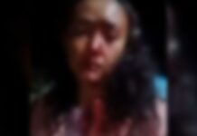 Mulher fica com o rosto desfigurado após ser agredida por pastor no interior de MS