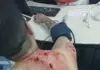 Homem chama motorista por aplicativo e tenta roubar moto com golpes de faca 