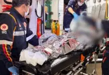 Adolescente fica com 80% do corpo queimado após explosão com álcool em confraternização