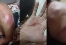 Família denuncia que policiais torturaram jovem com faca, marteladas e saco na cabeça
